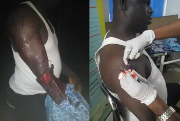 Photos: Ward Councillor shot by gunmen in Delta State